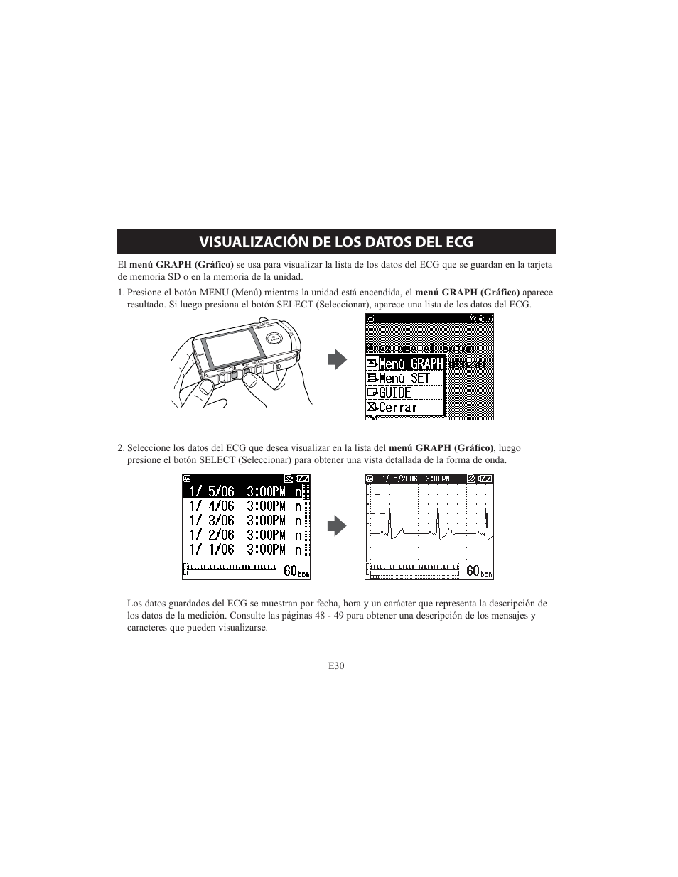 Visualización de los datos del ecg | Omron HCG-801 User Manual | Page 94 / 128