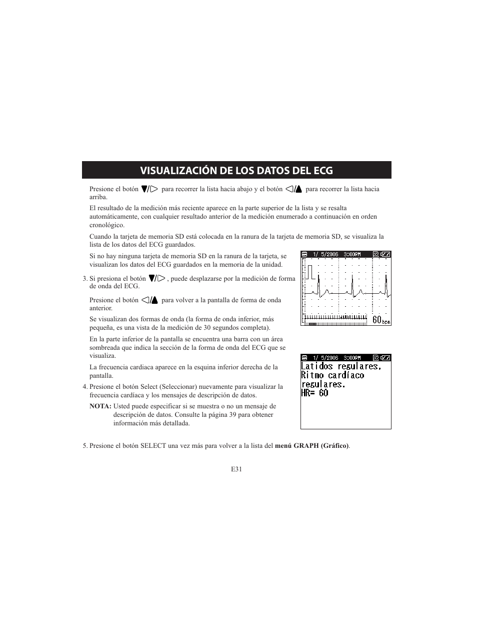 Visualización de los datos del ecg | Omron HCG-801 User Manual | Page 95 / 128