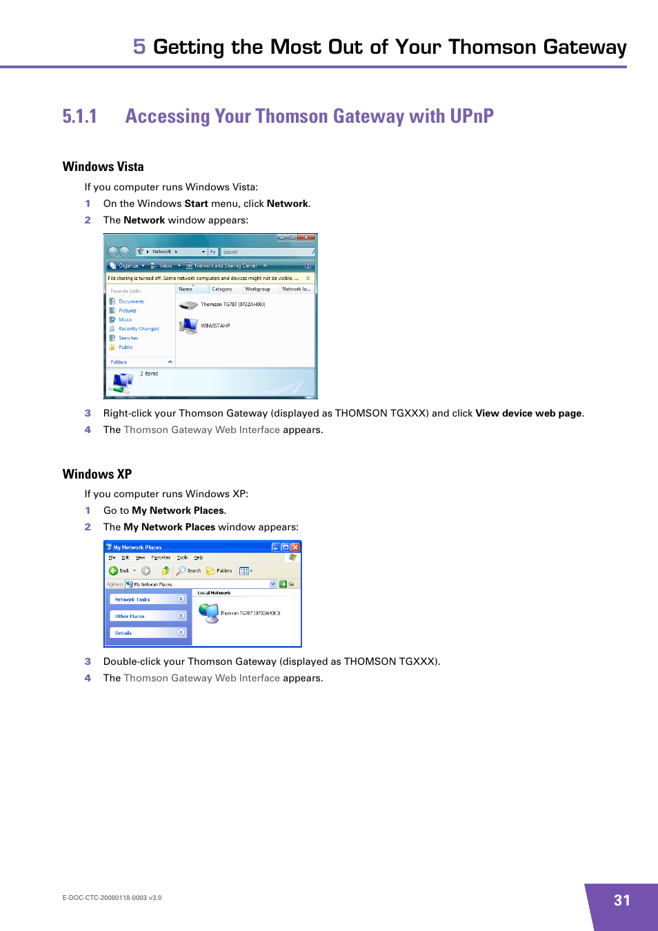 1 accessing your thomson gateway with upnp, Windows vista, Windows xp | Accessing your thomson gateway with upnp | Technicolor - Thomson TG576 v7 User Manual | Page 37 / 62