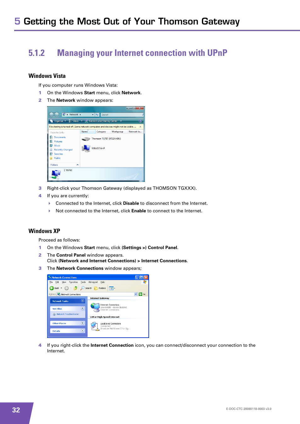 2 managing your internet connection with upnp, Windows vista, Windows xp | Managing your internet connection with upnp | Technicolor - Thomson TG576 v7 User Manual | Page 38 / 62