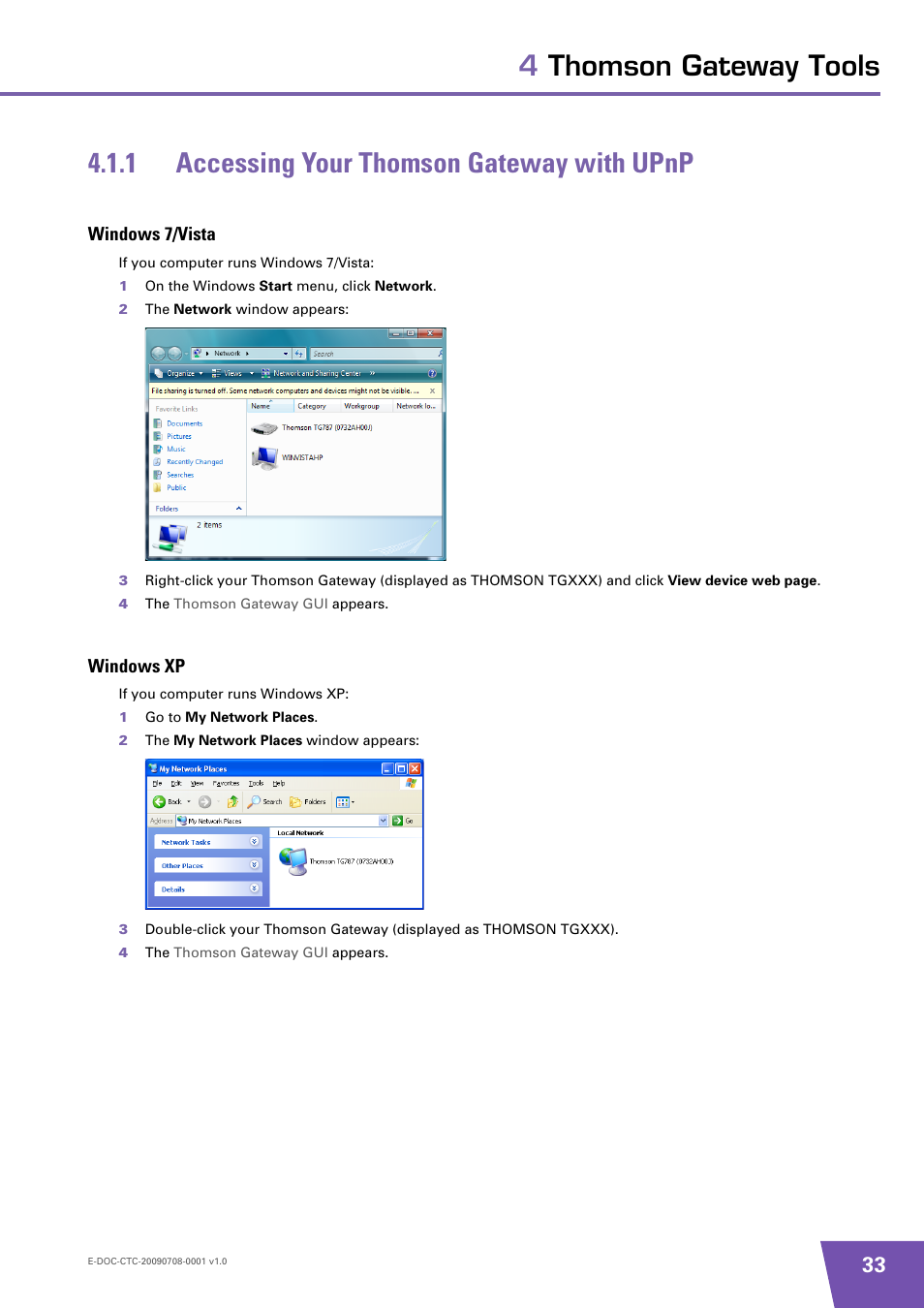 1 accessing your thomson gateway with upnp, Windows 7/vista, Windows xp | Accessing your thomson gateway with upnp | Technicolor - Thomson TG585 V8 User Manual | Page 39 / 60