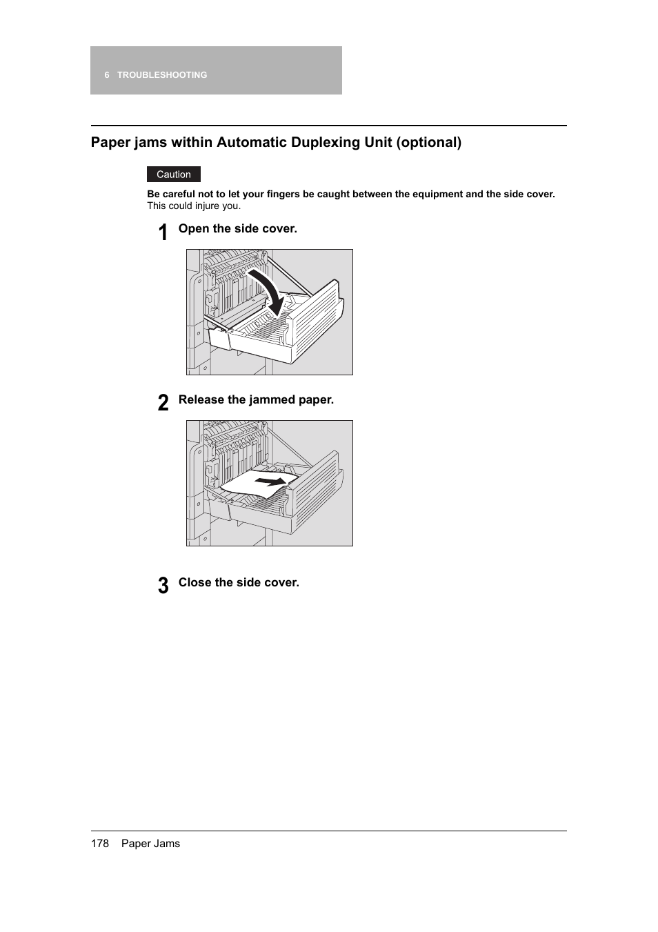 Plexing unit ( p.178) | Toshiba 165 User Manual | Page 180 / 224