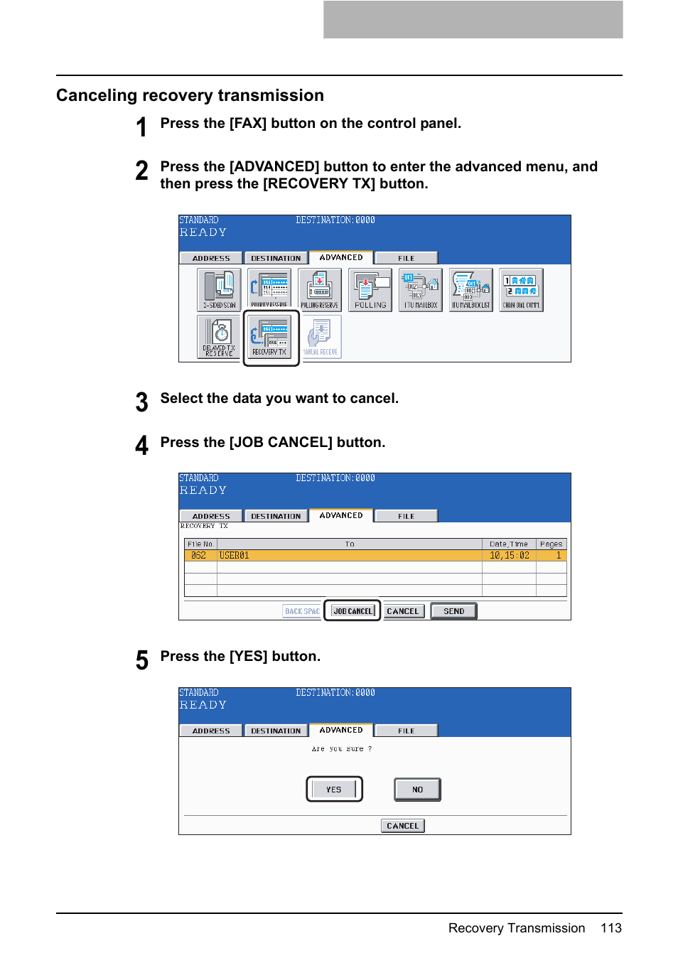 Canceling recovery transmission | Toshiba GD-1210 User Manual | Page 115 / 190
