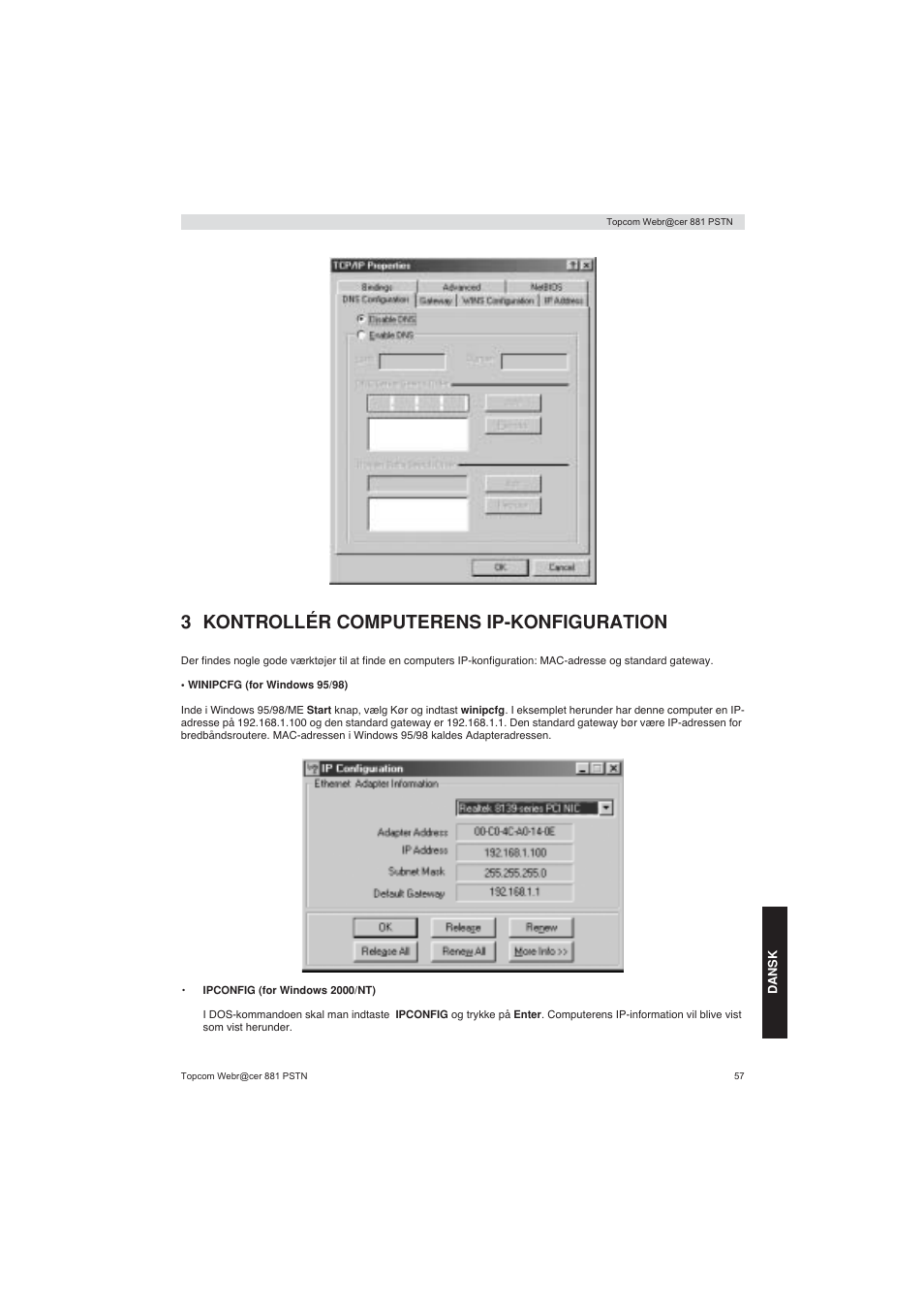 3 kontrollér computerens ip-konfiguration | Topcom Webracer 881 PSTN User Manual | Page 57 / 96