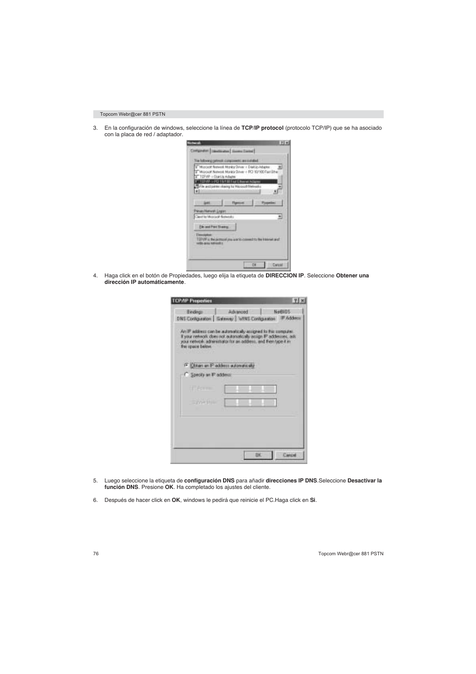 Topcom Webracer 881 PSTN User Manual | Page 76 / 96