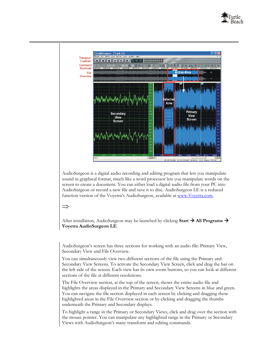 Audiosurgeon le | Turtle Beach Audio Advantage Amigo TBS-1121-01 User Manual | Page 34 / 38