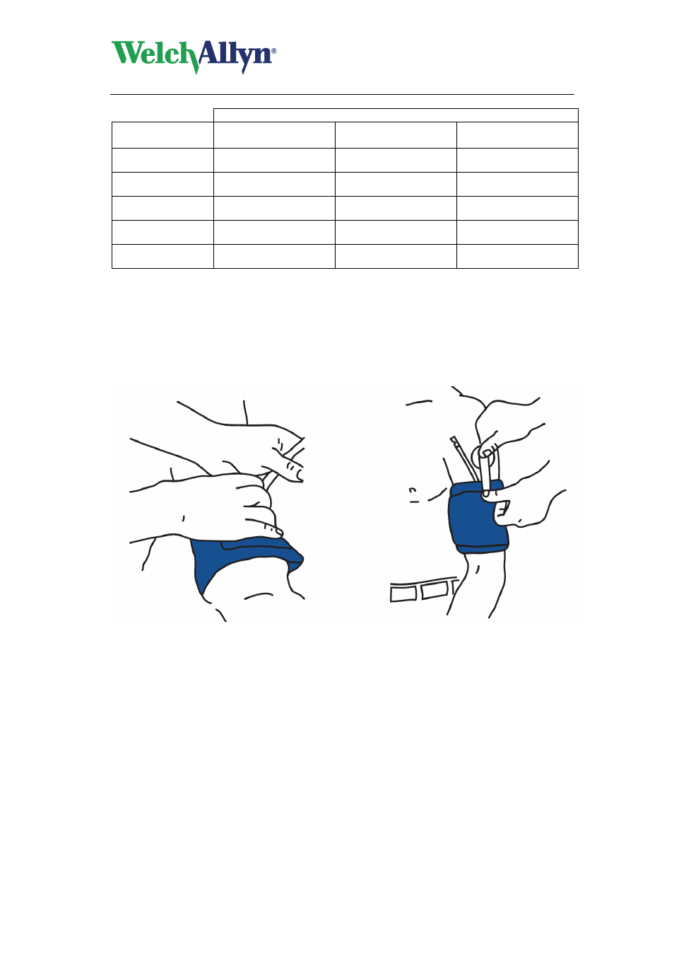 4 traditional cuff placement, Traditional cuff, 5 sleeve cuff placement | Traditional cuff placement, Sleeve cuff placement, Abpm 6100 hardware manual | Welch Allyn ABPM 6100 User Manual | Page 12 / 30