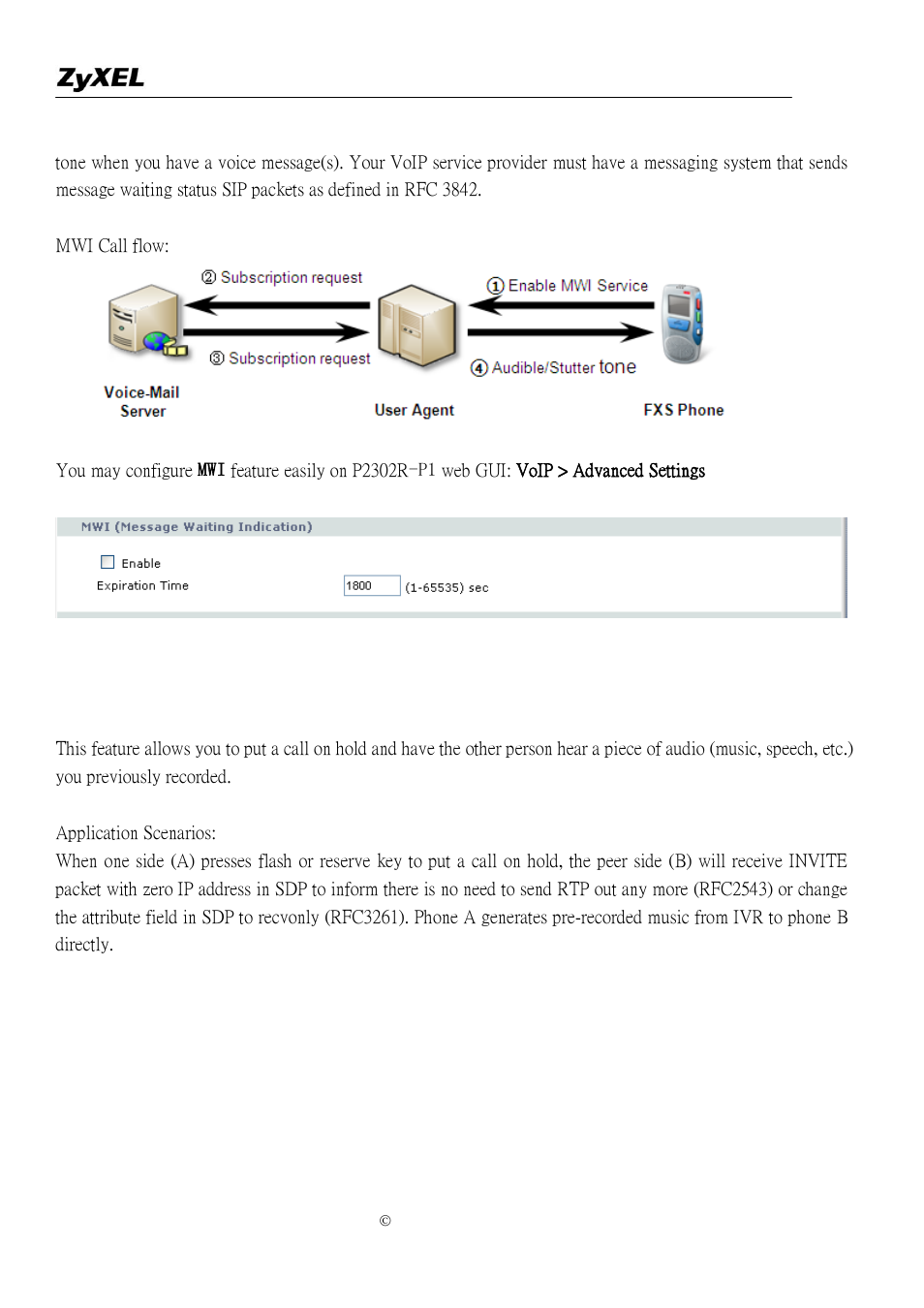 Music on hold | ZyXEL Communications P-2302R-P1 User Manual | Page 92 / 146