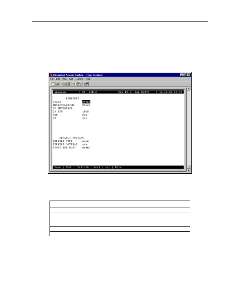 2 ethernet and default ip screen | Zhone Technologies 600 User Manual | Page 221 / 240