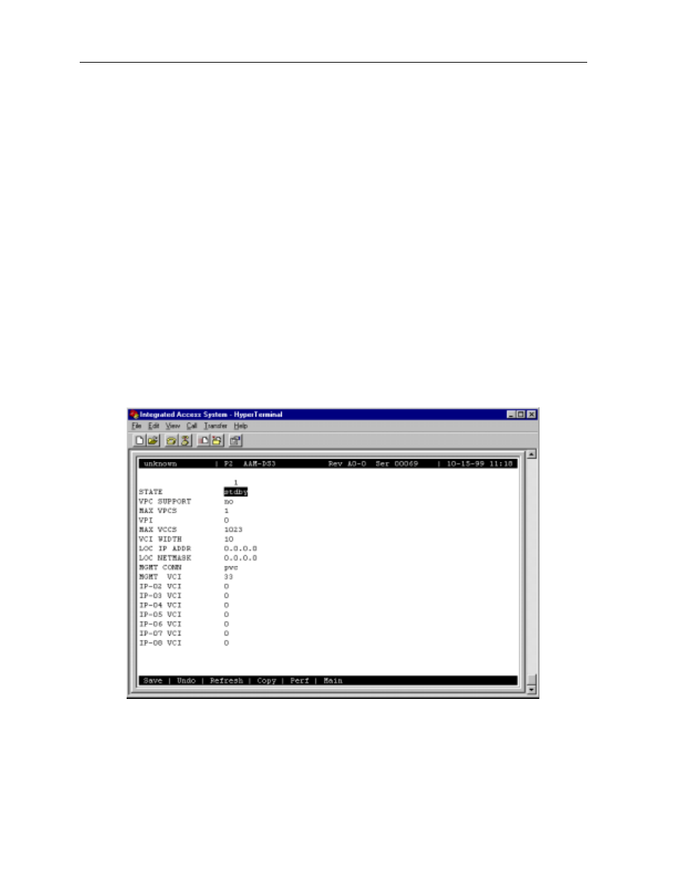 2 user network interface screen (uni) | Zhone Technologies 600 User Manual | Page 80 / 240