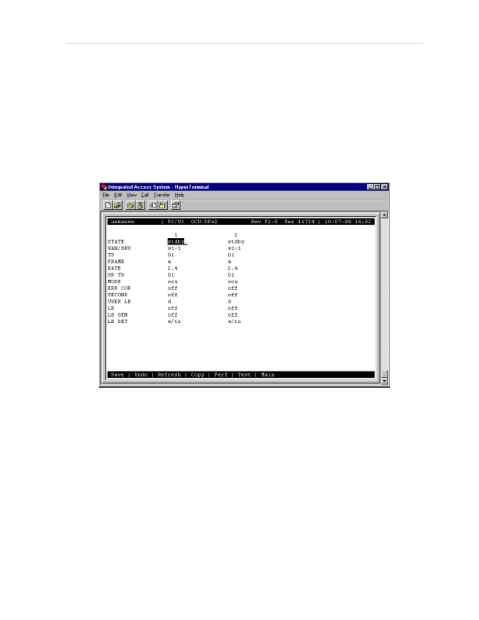 3 ocu-dp card user screens and settings, 1 ocu-dp card main screen | Zhone Technologies 900 User Manual | Page 91 / 176
