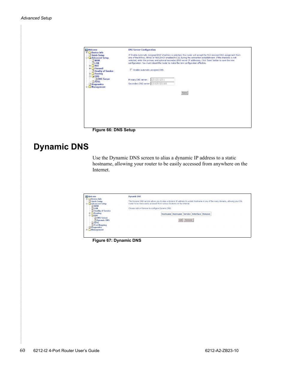 Dynamic dns | Zhone Technologies 6212-I2 User Manual | Page 60 / 84