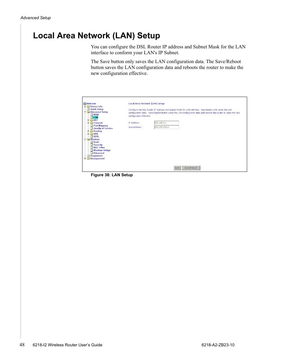 Local area network (lan) setup | Zhone Technologies 6218-I2 User Manual | Page 48 / 94