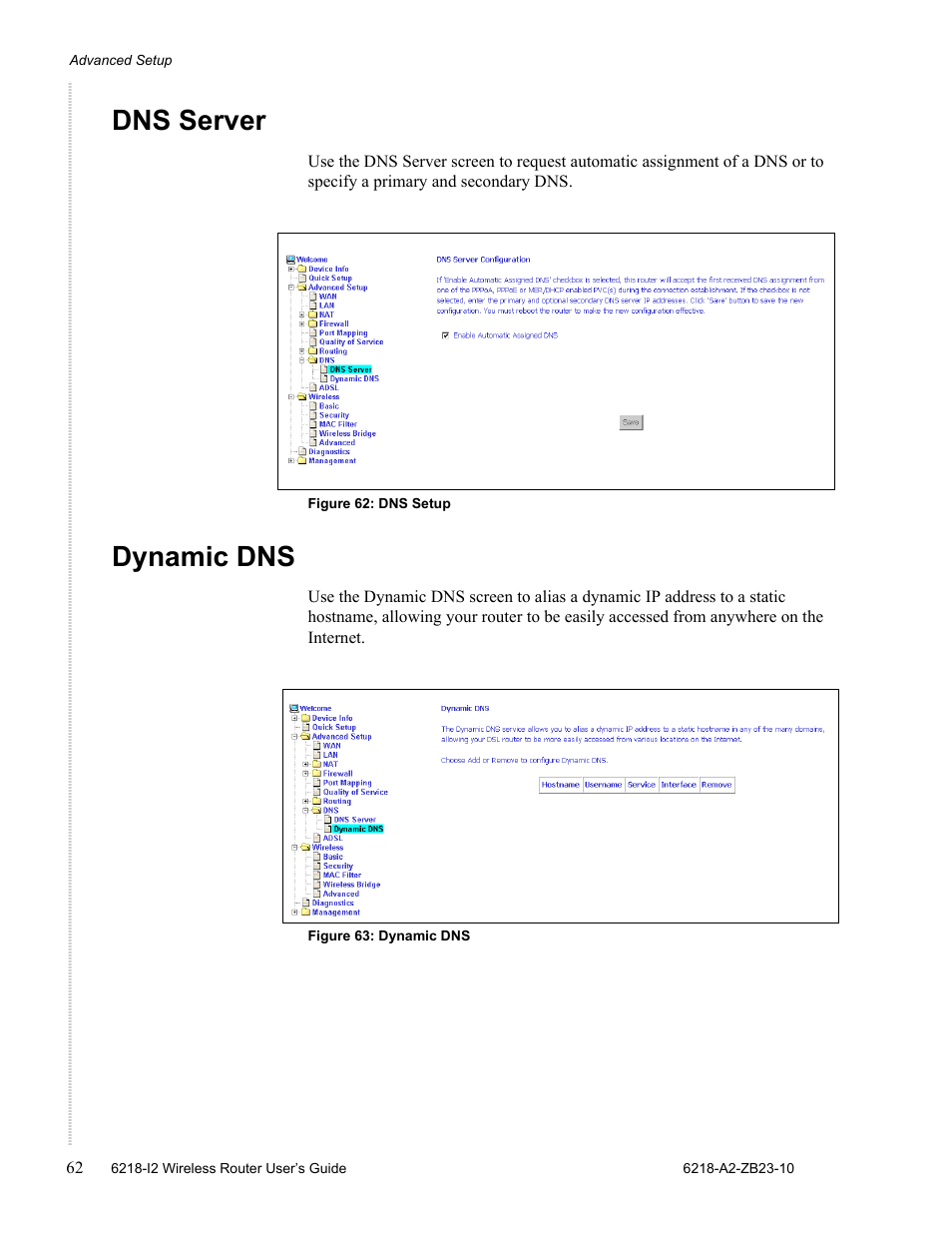 Dns server, Dynamic dns | Zhone Technologies 6218-I2 User Manual | Page 62 / 94