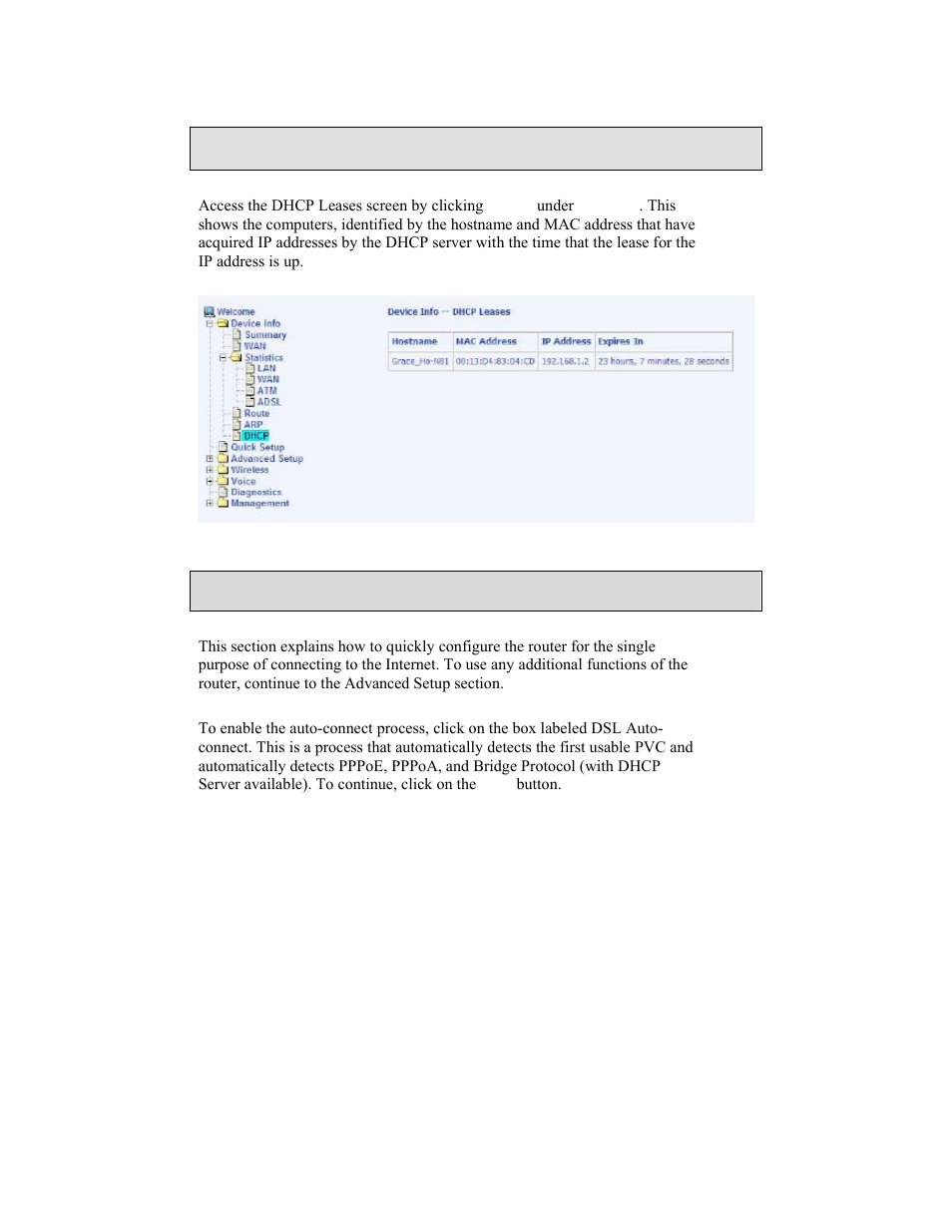 Quick setup, Dhcp | Zhone Technologies 6238-I2 User Manual | Page 25 / 79
