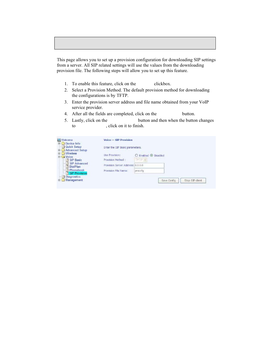 Sip provision | Zhone Technologies 6238-I2 User Manual | Page 67 / 79