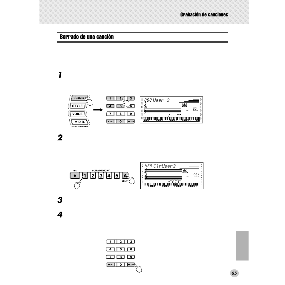 Borrado de una canción | Yamaha Portable Grand DGX-300 User Manual | Page 65 / 116