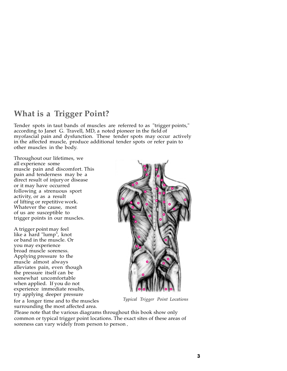 What is a trigger point | Activeforever The Original Backnobber II User Manual | Page 5 / 37