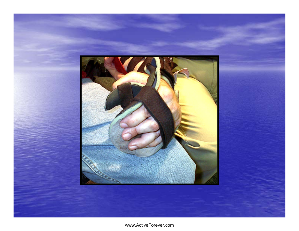Static hand piece | Activeforever Saebo Stretch Hand Splint - SaeboStretch User Manual | Page 12 / 38