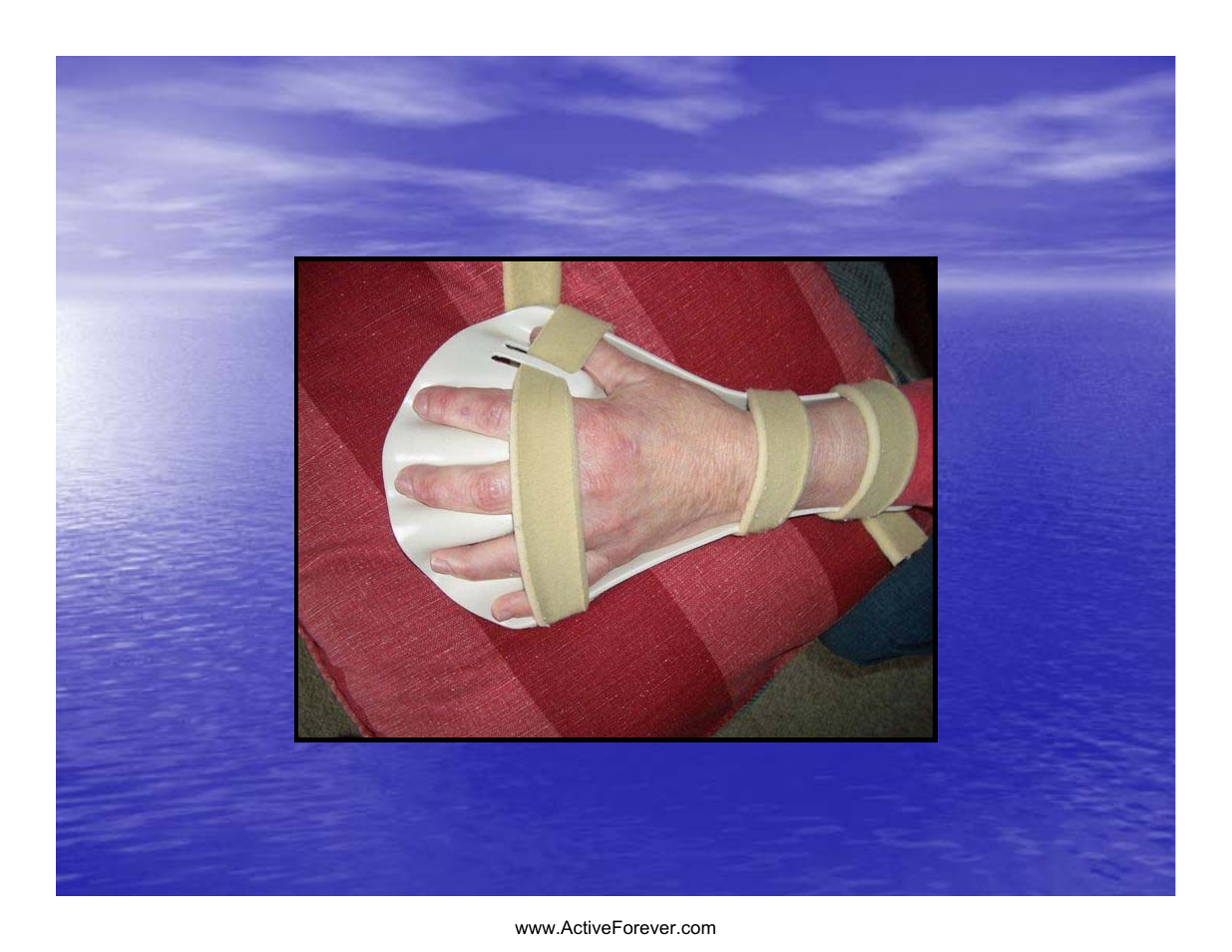 Static hand piece | Activeforever Saebo Stretch Hand Splint - SaeboStretch User Manual | Page 14 / 38