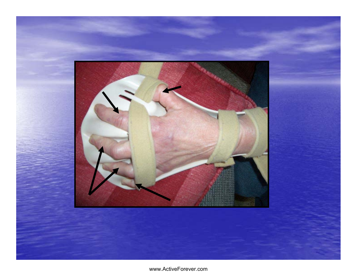 Static hand piece, During exertion | Activeforever Saebo Stretch Hand Splint - SaeboStretch User Manual | Page 15 / 38