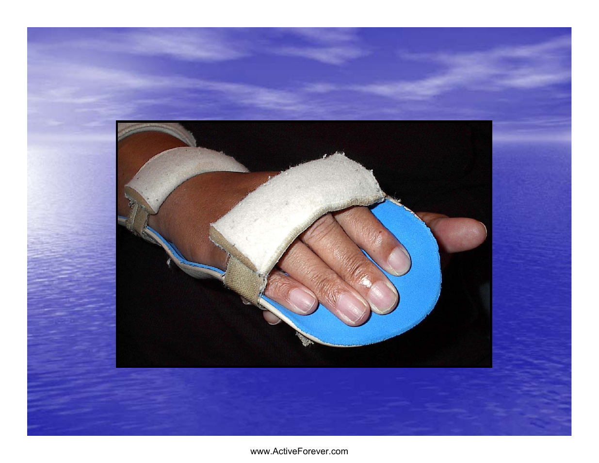 Static hand piece | Activeforever Saebo Stretch Hand Splint - SaeboStretch User Manual | Page 16 / 38
