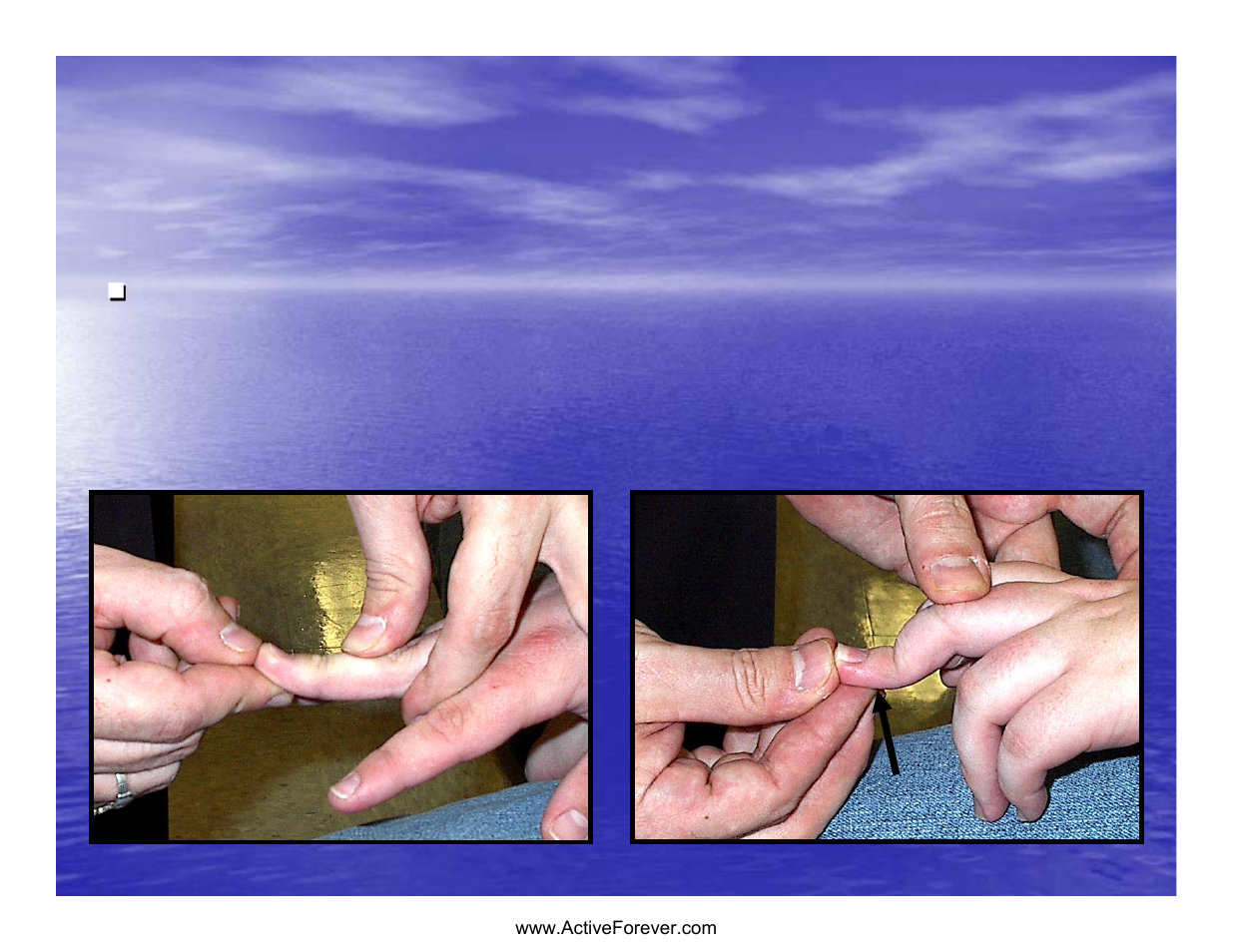 Static hand piece | Activeforever Saebo Stretch Hand Splint - SaeboStretch User Manual | Page 18 / 38
