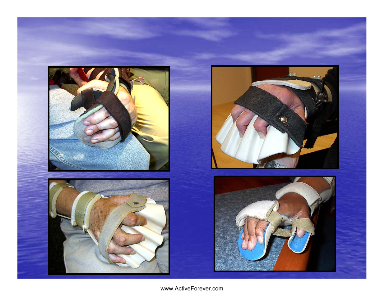 Should static splints be contraindicated | Activeforever Saebo Stretch Hand Splint - SaeboStretch User Manual | Page 19 / 38