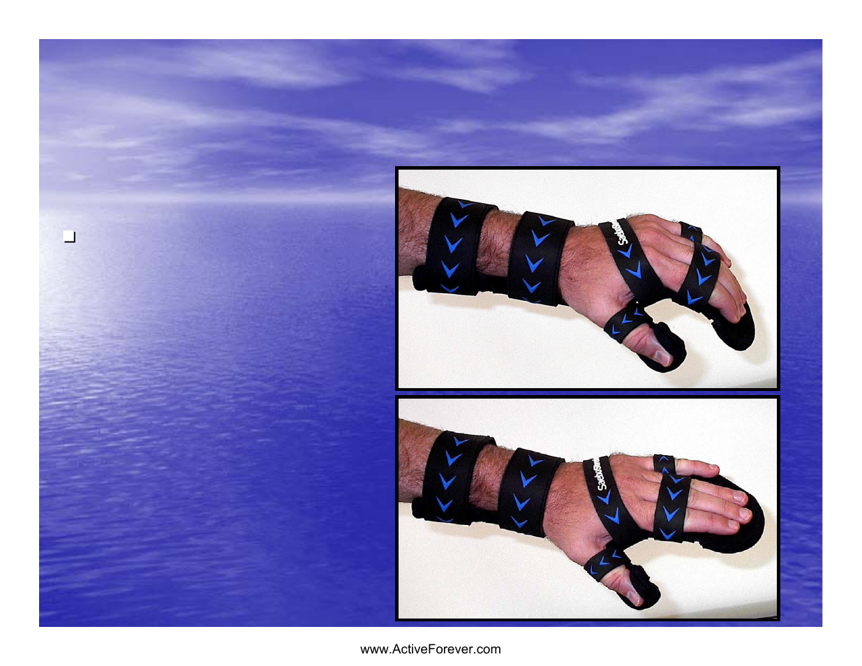 Dynamic hand piece | Activeforever Saebo Stretch Hand Splint - SaeboStretch User Manual | Page 21 / 38