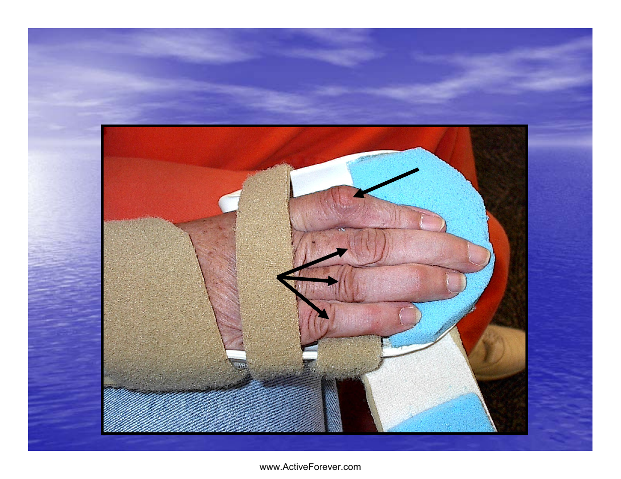 Strap location | Activeforever Saebo Stretch Hand Splint - SaeboStretch User Manual | Page 25 / 38
