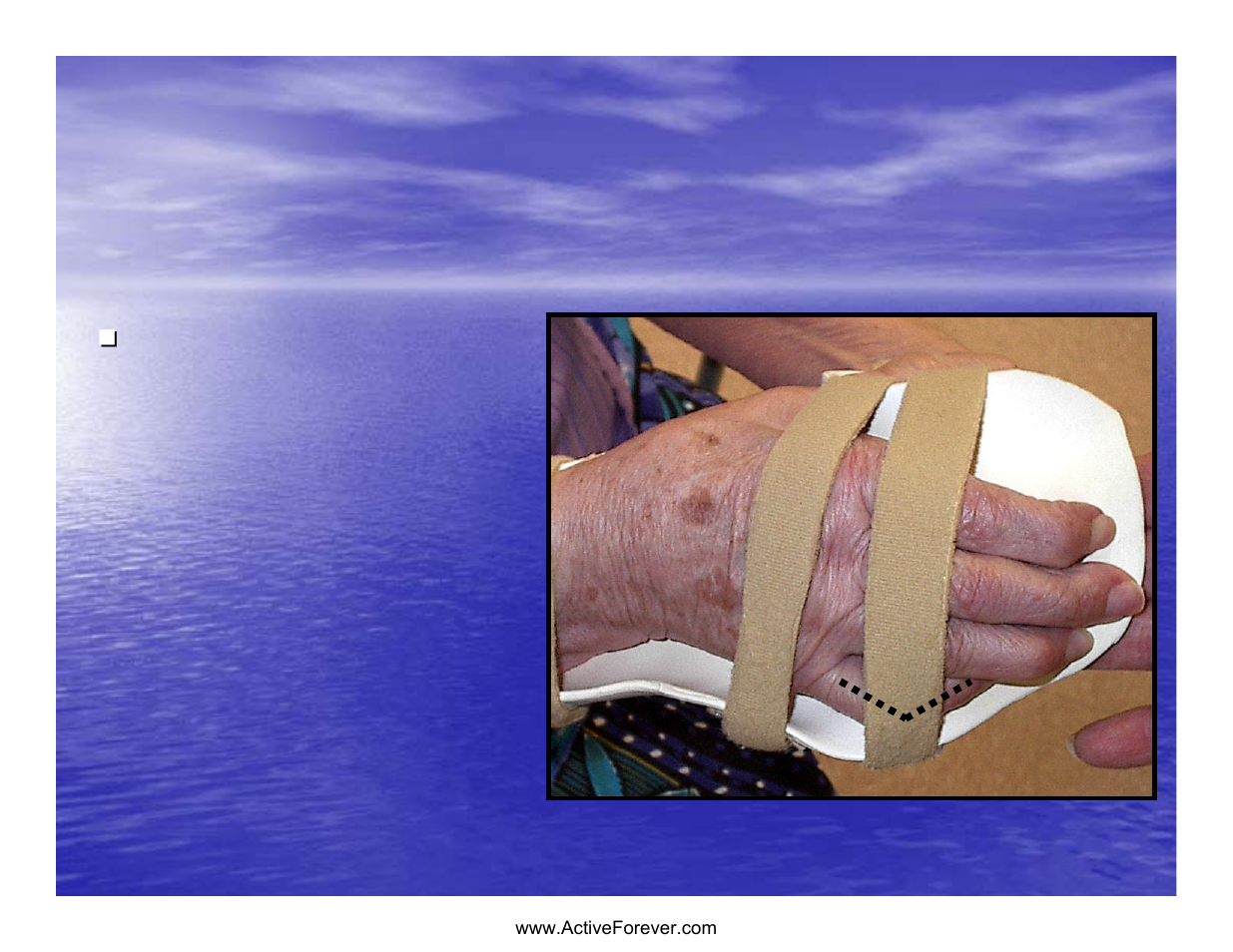 Strap location | Activeforever Saebo Stretch Hand Splint - SaeboStretch User Manual | Page 26 / 38