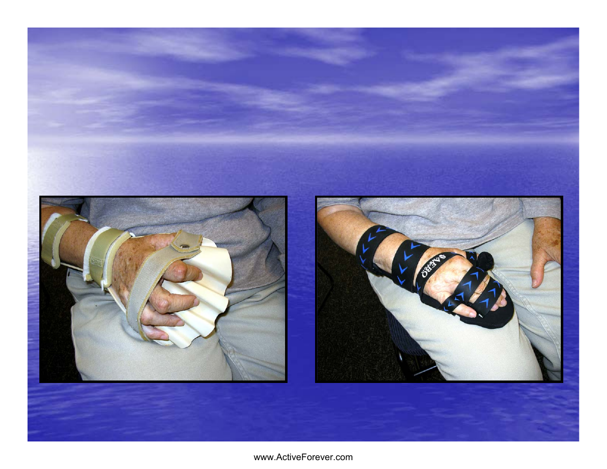 Does strap location & material | Activeforever Saebo Stretch Hand Splint - SaeboStretch User Manual | Page 32 / 38