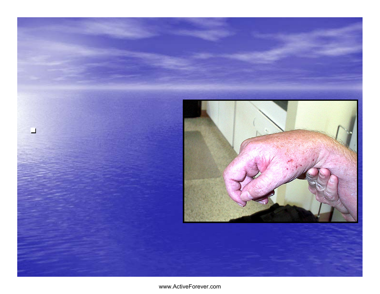 Should the patient be splinted | Activeforever Saebo Stretch Hand Splint - SaeboStretch User Manual | Page 5 / 38