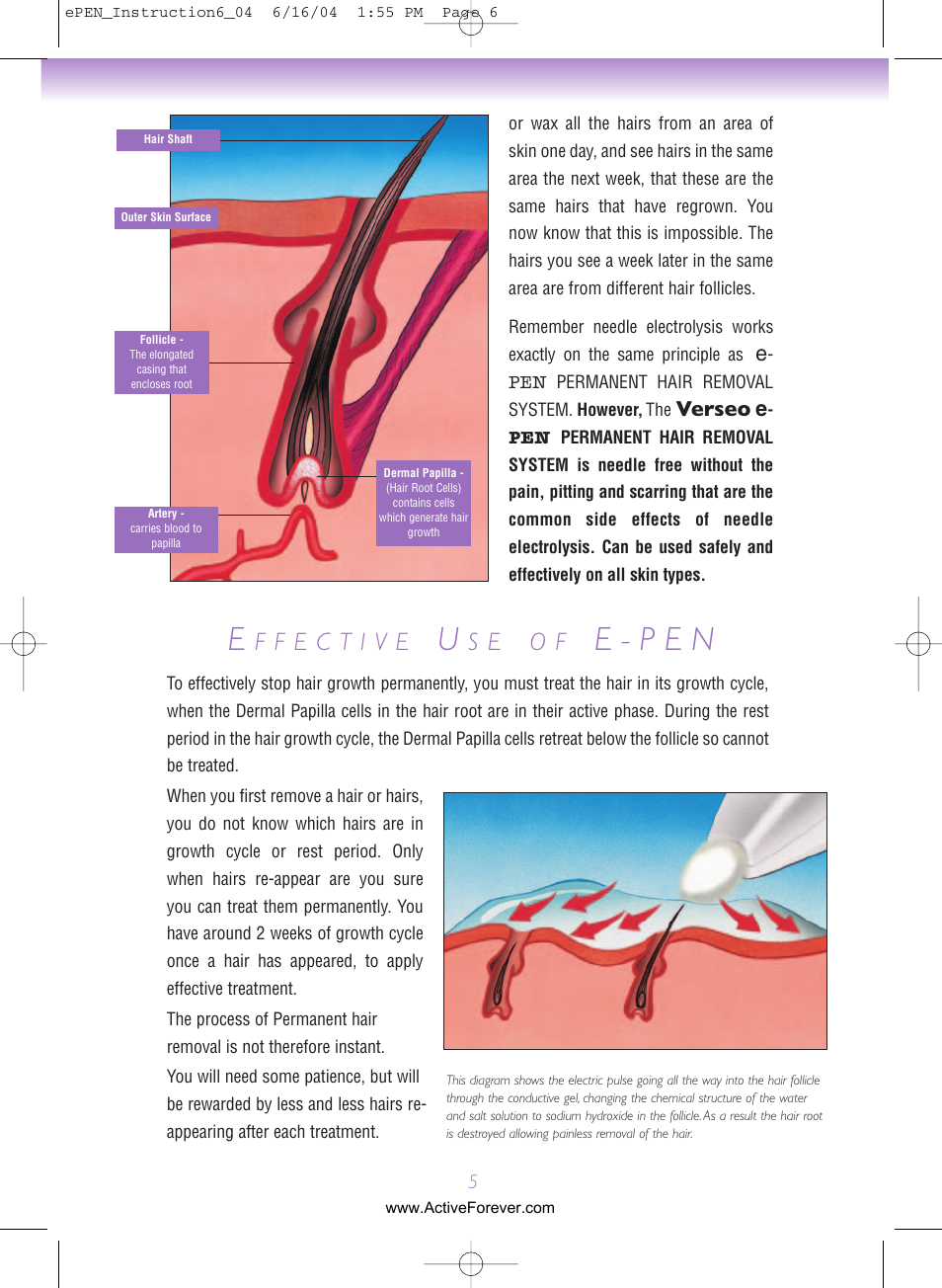 E - p e n, S e o f, Verseo e | Activeforever Verseo ePen Permanent Hair Removal System User Manual | Page 6 / 15