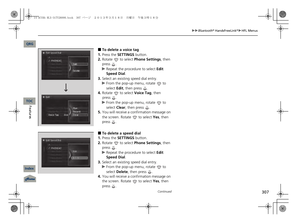 Acura 2014 RLX User Manual | Page 308 / 518