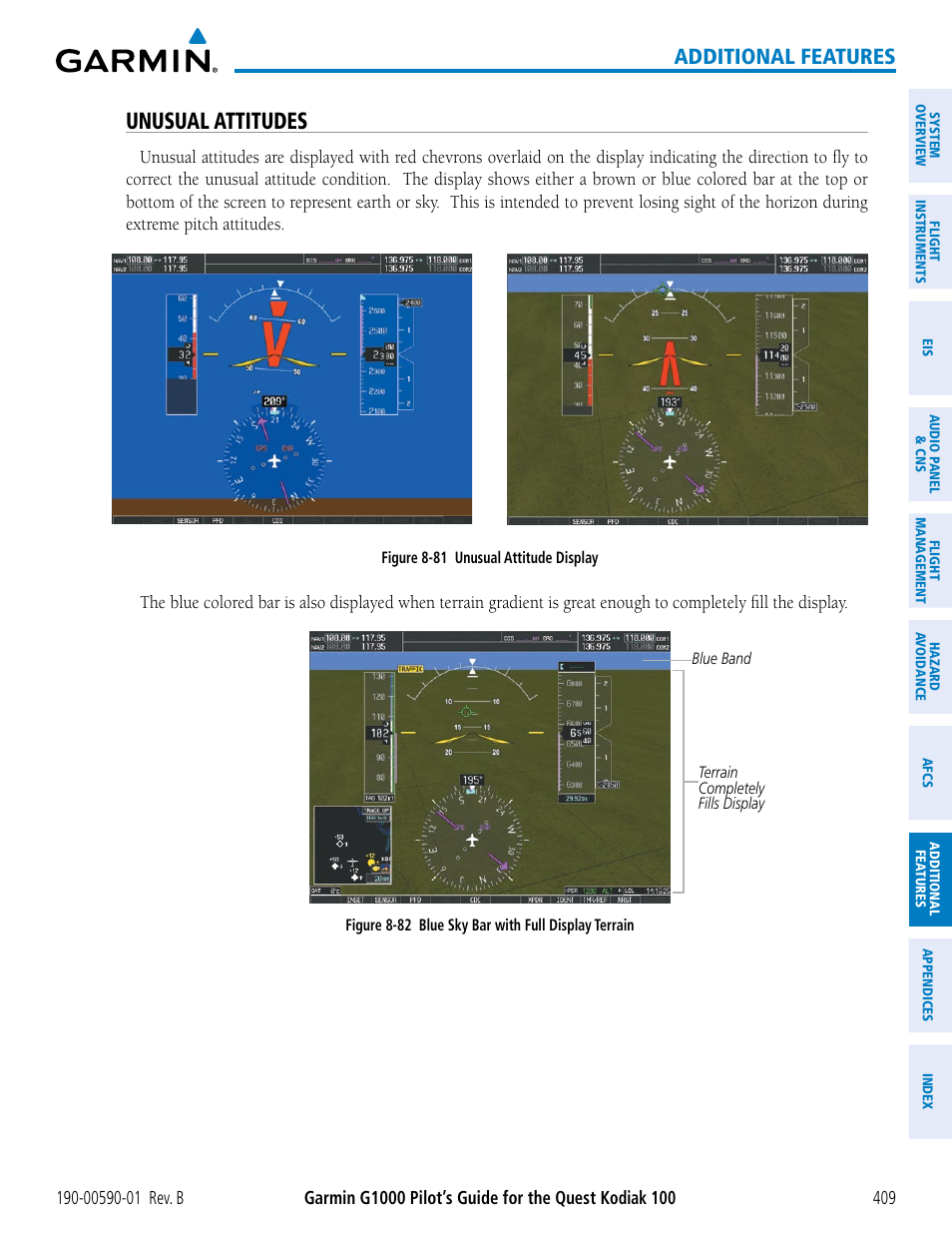 Unusual attitudes, Additional features | Garmin G1000 Quest Kodiak User Manual | Page 421 / 476