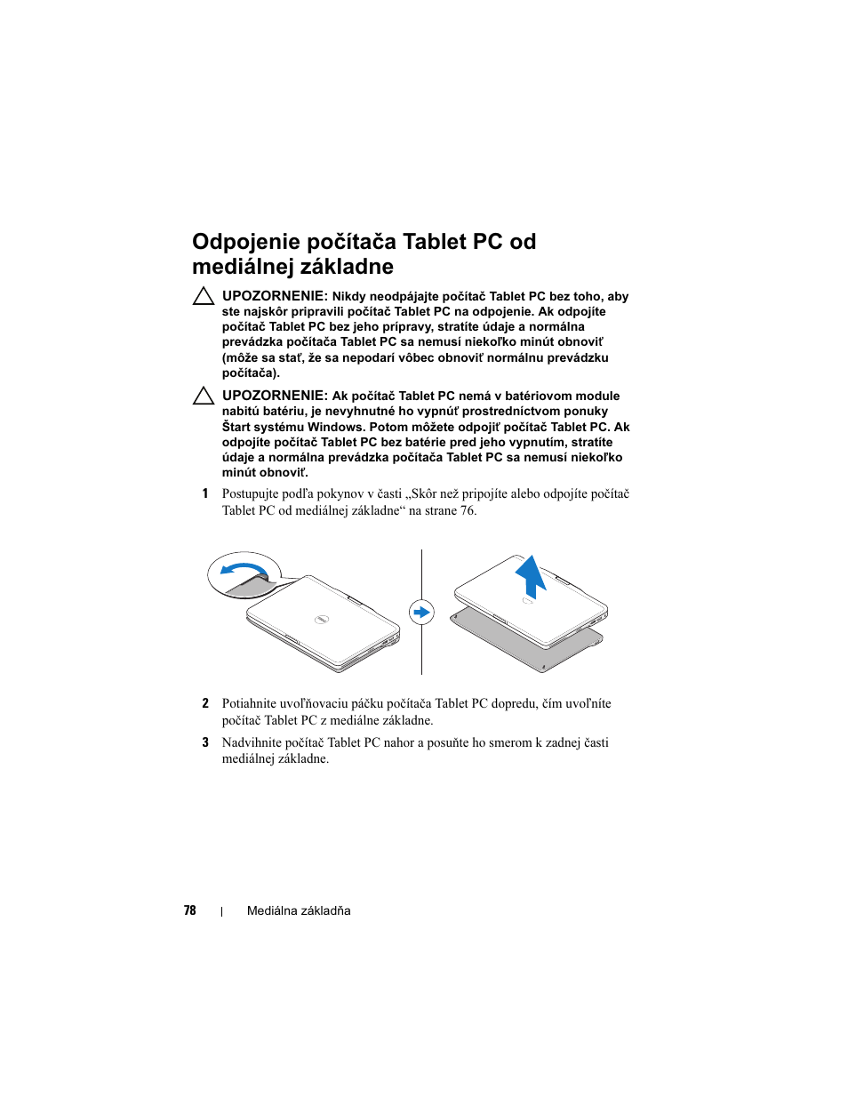 Odpojenie počítača tablet pc od mediálnej základne | Dell Latitude XT3 User Manual | Page 80 / 108