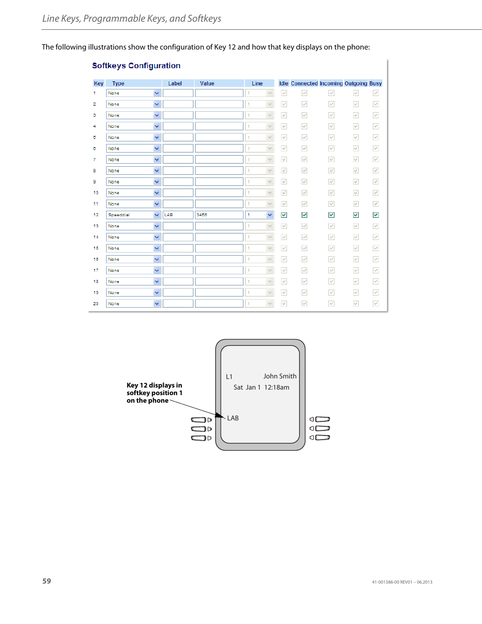 Line keys, programmable keys, and softkeys | AASTRA 6755i User Guide EN User Manual | Page 66 / 221