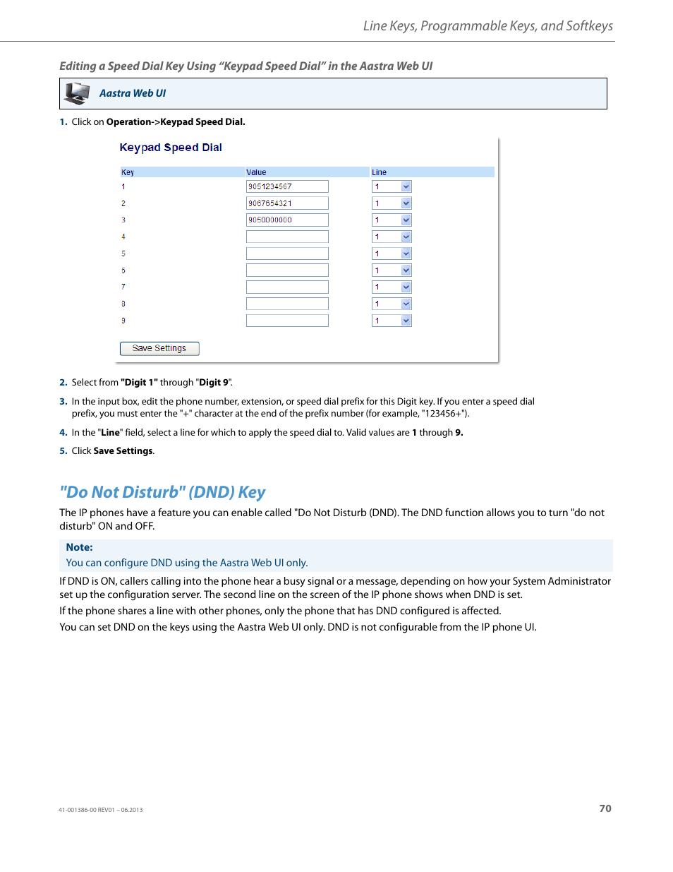 Do not disturb" (dnd) key, Line keys, programmable keys, and softkeys | AASTRA 6755i User Guide EN User Manual | Page 77 / 221