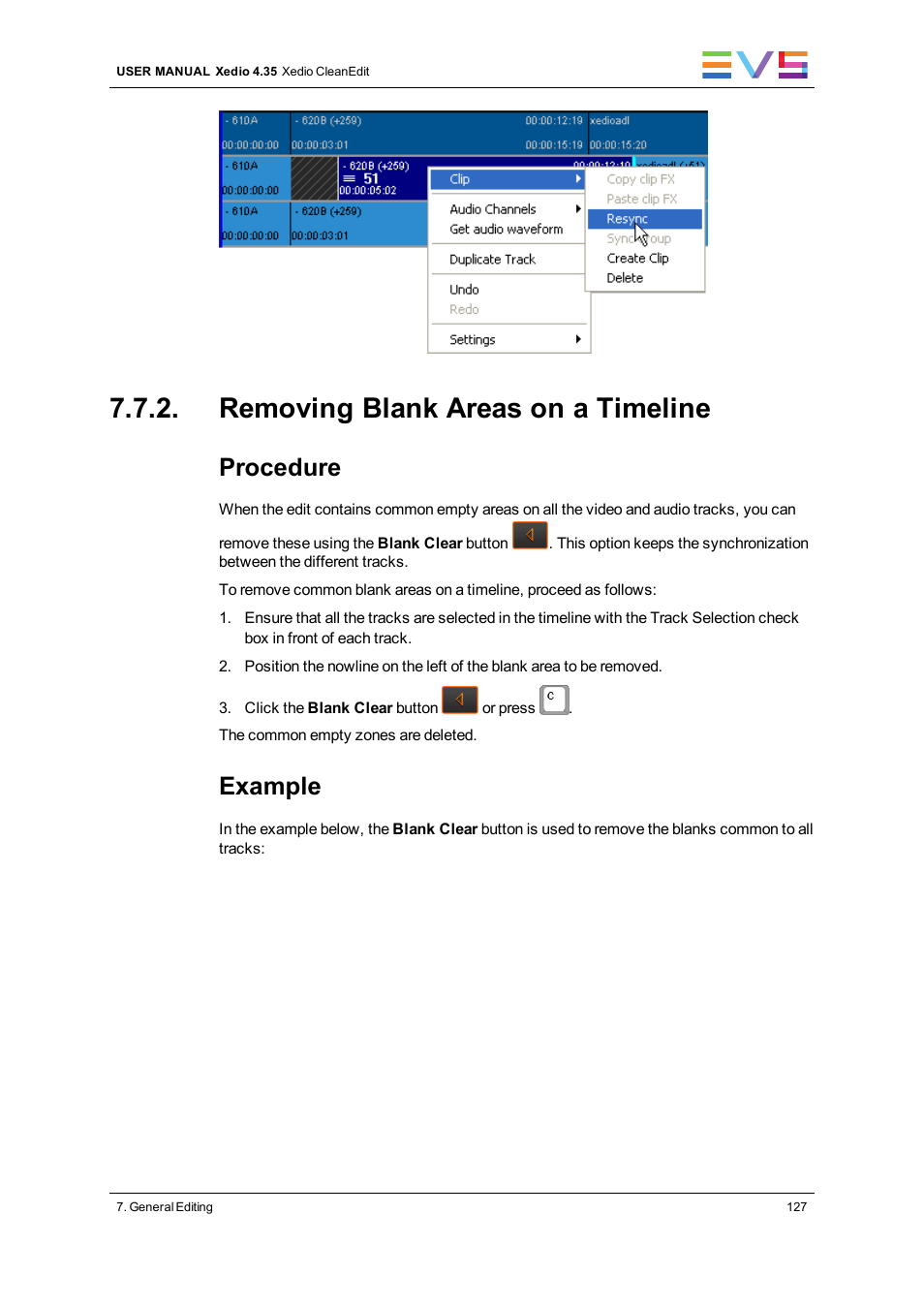 Removing blank areas on a timeline, Procedure, Example | EVS XEDIO CleanEdit Version 4.35 - August 2013 User Manual User Manual | Page 143 / 256