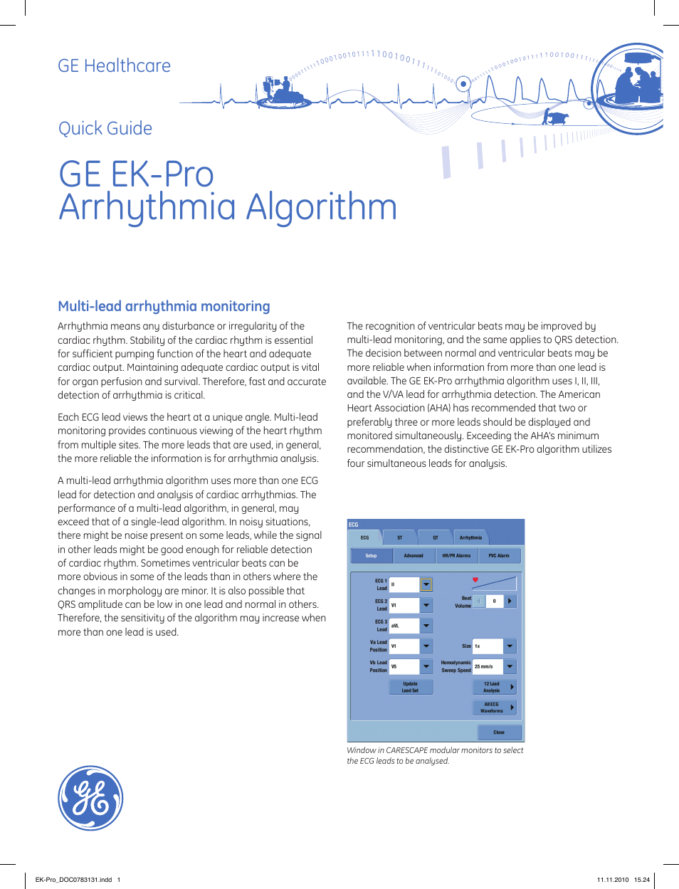 GE Healthcare GE EK-Pro Arrhythmia Algorithm User Manual | 4 pages