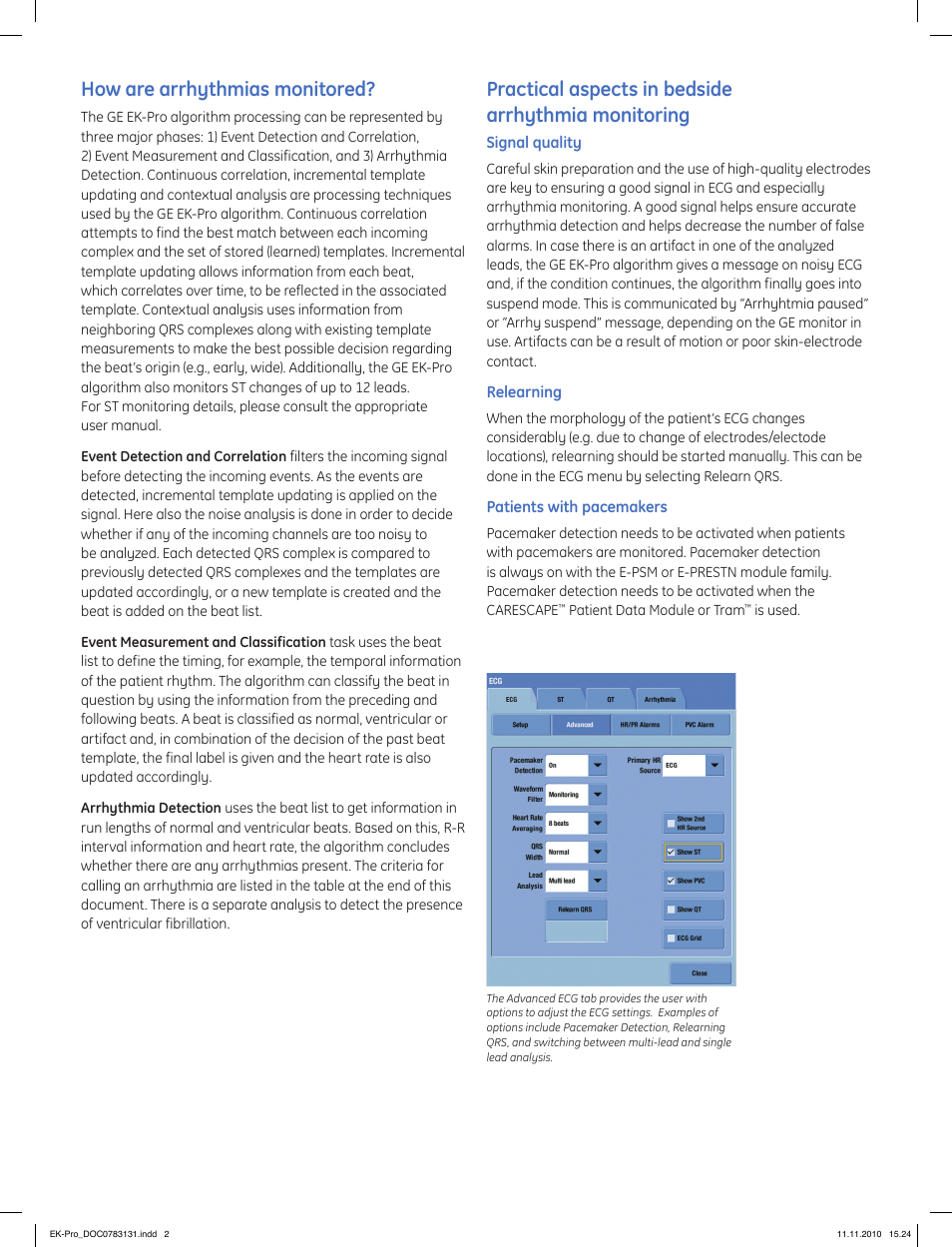 How are arrhythmias monitored, Practical aspects in bedside arrhythmia monitoring | GE Healthcare GE EK-Pro Arrhythmia Algorithm User Manual | Page 2 / 4