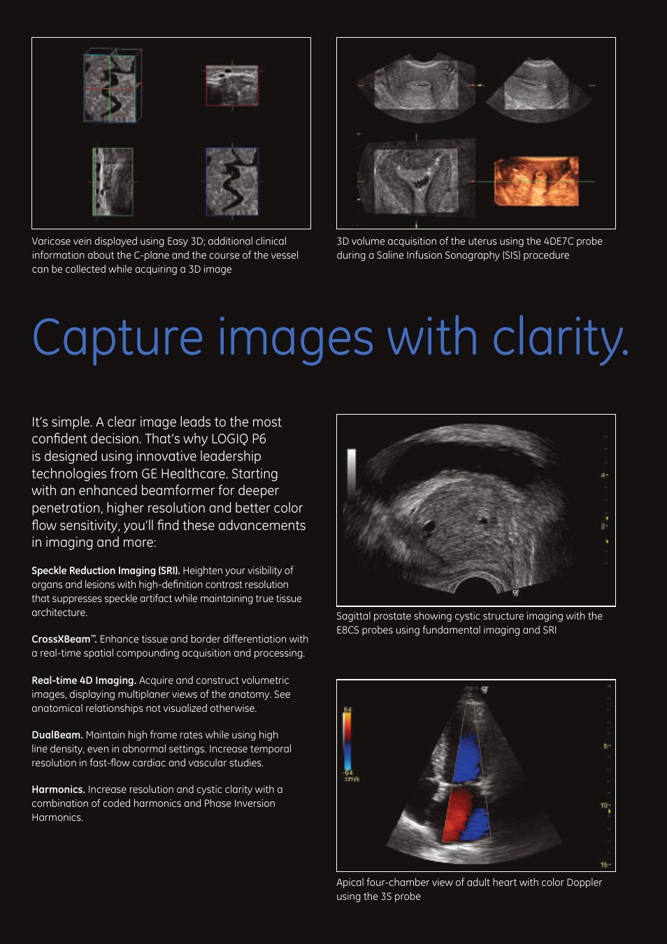 Capture images with clarity | GE Healthcare LOGIQ P6 User Manual | Page 4 / 8