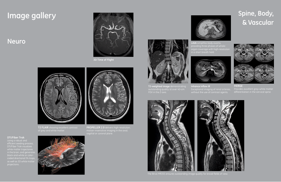 Image gallery, Neuro spine, body, & vascular | GE Healthcare Brivo MR355 1.5T User Manual | Page 5 / 7