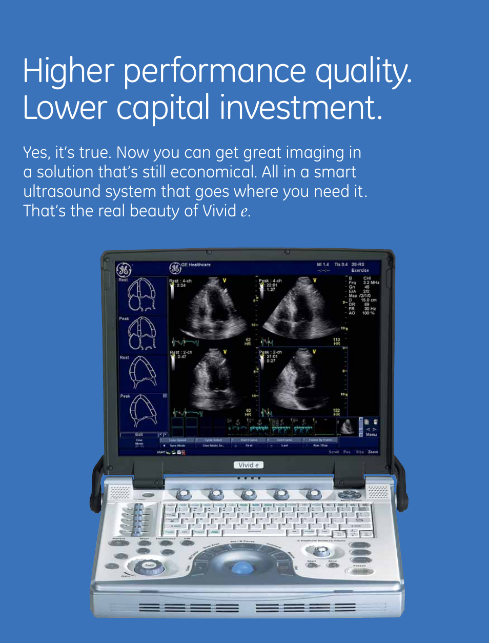 GE Healthcare Vivid q User Manual | Page 2 / 8