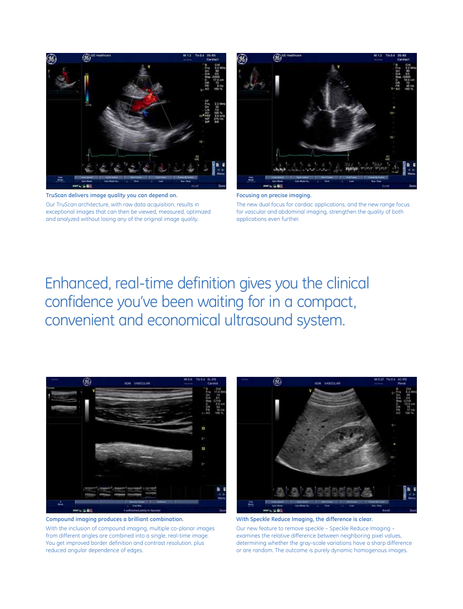 GE Healthcare Vivid q User Manual | Page 5 / 8