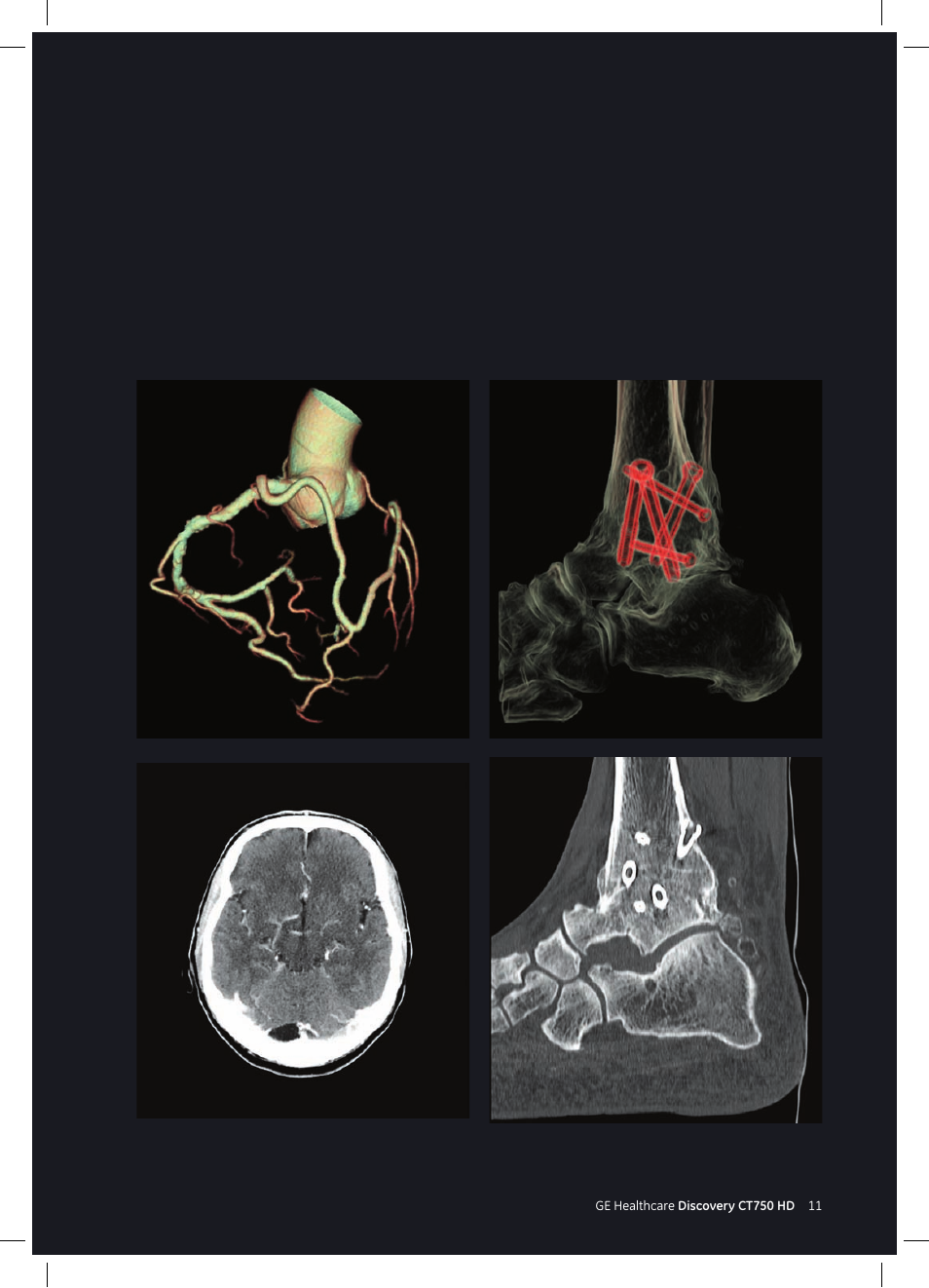 GE Healthcare Discovery CT750 HD User Manual | Page 11 / 49