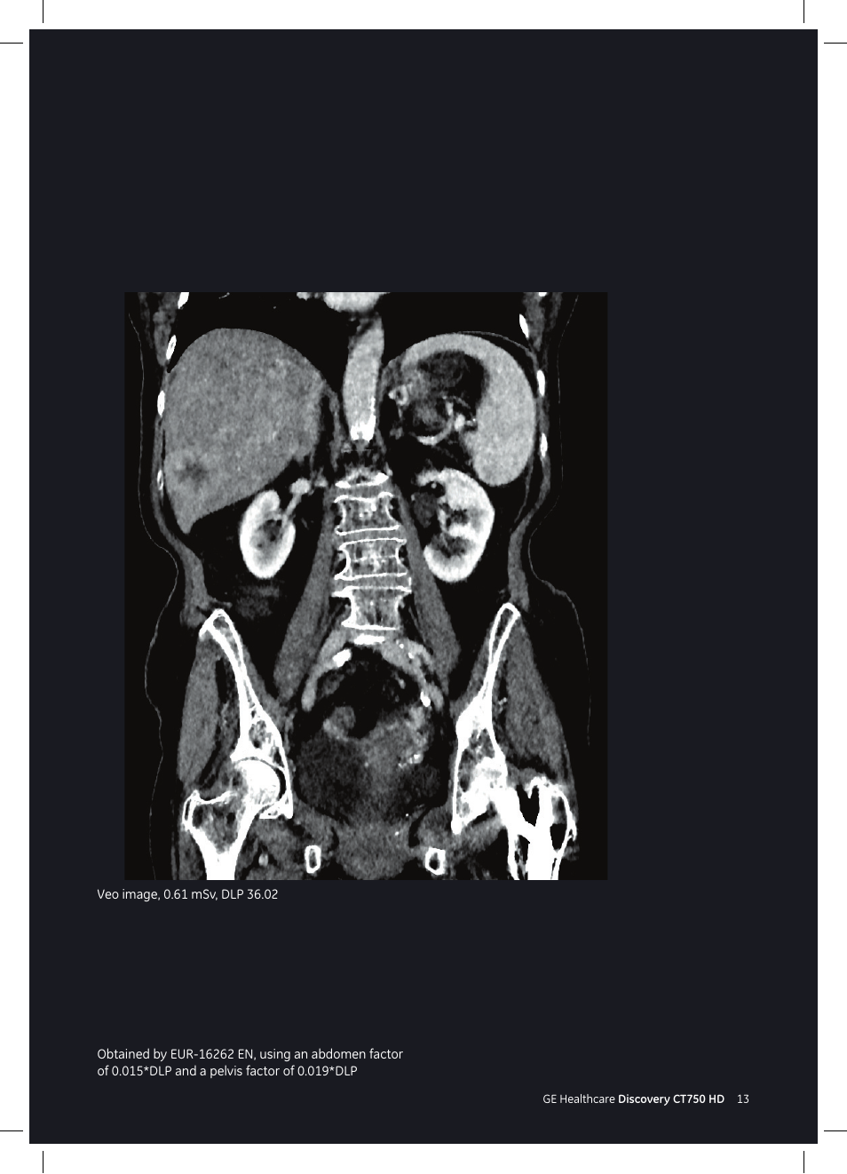 GE Healthcare Discovery CT750 HD User Manual | Page 13 / 49