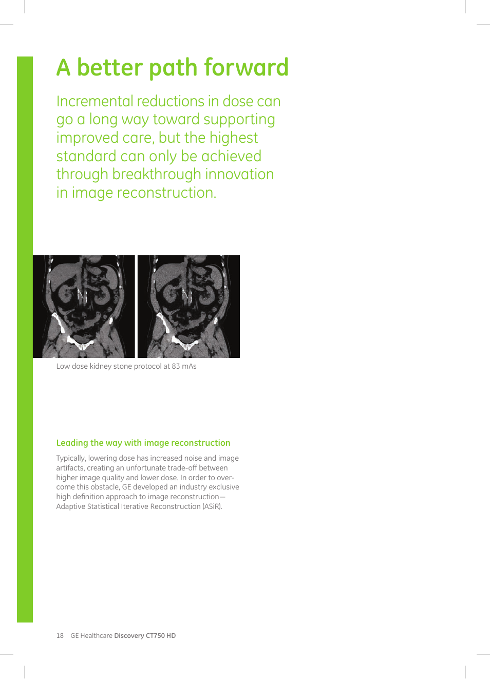 A better path forward | GE Healthcare Discovery CT750 HD User Manual | Page 18 / 49