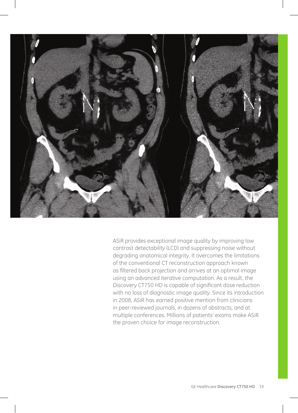 GE Healthcare Discovery CT750 HD User Manual | Page 19 / 49